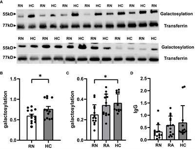 Reduced serum IgG galactosylation is associated with increased inflammation during relapses of neuromyelitis optica spectrum disorders